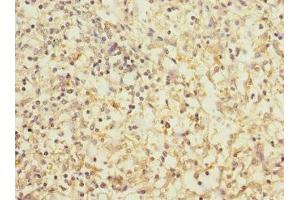 Immunohistochemistry of paraffin-embedded human spleen tissue using ABIN7171372 at dilution of 1:100 (CD1c 抗体  (AA 18-300))