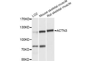 Western blot analysis of extracts of various cell lines, using ACTN3 antibody (ABIN6290057) at 1:3000 dilution. (ACTN3 抗体)