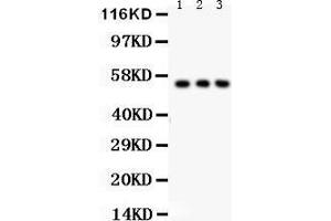Anti- SLC2A2 Picoband antibody, Western blotting All lanes: Anti SLC2A2  at 0. (SLC2A2 抗体  (C-Term))