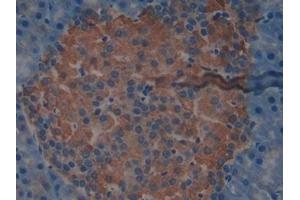 Immunohistochemistry (IHC) image for anti-ATP-Binding Cassette, Sub-Family C (CFTR/MRP), Member 1 (ABCC1) (AA 1219-1469) antibody (ABIN7440026)
