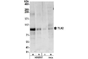 Western Blotting (WB) image for anti-Tousled-Like Kinase 2 (TLK2) (AA 722-772) antibody (ABIN7450827)