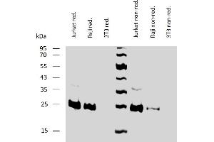 Western blotting analysis of human BCL2 using mouse monoclonal antibody Bcl-2/100 on lysates of Jurkat and Raji cells, and 3T3 cells (negative control) under reducing and non-reducing conditions. (Bcl-2 抗体  (AA 41-54))