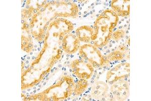 Immunohistochemistry (Paraffin-embedded Sections) (IHC (p)) image for anti-Cytochrome P450, Family 20, Subfamily A, Polypeptide 1 (CYP20A1) antibody (ABIN7073675)