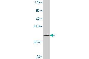 Western Blot detection against Immunogen (36. (PDE4C 抗体  (AA 1-99))