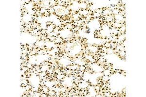 Immunohistochemistry (Paraffin-embedded Sections) (IHC (p)) image for anti-General Transcription Factor IIB (GTF2B) antibody (ABIN7074034)