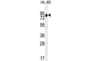 ZNF665 Antibody (N-term) western blot analysis in HL-60 cell line lysates (35 µg/lane). (ZNF665 抗体  (N-Term))