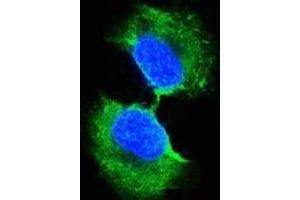 Confocal immunofluorescence analysis of PC-3 cells using GSTP1 antibody (green). (GSTP1 抗体)