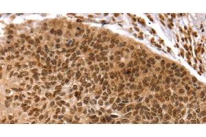 Immunohistochemistry (Paraffin-embedded Sections) (IHC (p)) image for anti-TAF10 RNA Polymerase II, TATA Box Binding Protein (TBP)-Associated Factor, 30kDa (TAF10) antibody (ABIN7239503)