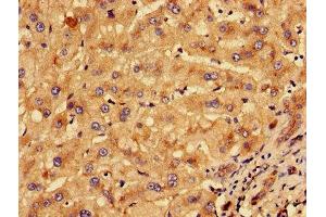 Immunohistochemistry of paraffin-embedded human liver tissue using ABIN7157273 at dilution of 1:100 (KLHL2 抗体  (AA 1-155))