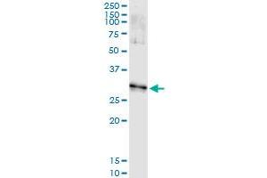 Immunoprecipitation of DLX1 transfected lysate using anti-DLX1 monoclonal antibody and Protein A Magnetic Bead , and immunoblotted with DLX1 MaxPab rabbit polyclonal antibody. (DLX1 抗体  (AA 152-255))