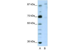 GLIS3 antibody (20R-1239) used at 0. (GLIS3 抗体  (N-Term))