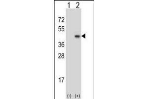 Western blot analysis of SYP (arrow) using rabbit polyclonal SYP Antibody (C-term) (ABIN6242563 and ABIN6577334). (Synaptophysin 抗体  (C-Term))