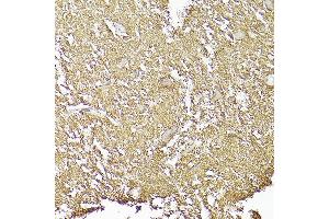 Immunohistochemistry of paraffin-embedded human brain using CD90/Thy1 Rabbit mAb (ABIN6129735, ABIN6148554, ABIN6148555 and ABIN7101405) at dilution of 1:100 (40x lens). (CD90 抗体)