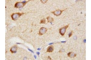 IHC-P: PPID antibody testing of rat brain tissue (PPID 抗体  (AA 351-370))