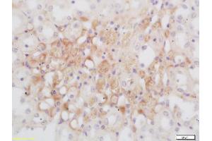 Formalin-fixed and paraffin embedded rat kidney labeled with Rabbit Anti GNMT Polyclonal Antibody, Unconjugated (ABIN739680) at 1:200 followed by conjugation to the secondary antibody and DAB staining (GNMT 抗体  (AA 51-150))