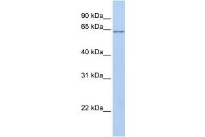WB Suggested Anti-ANGPTL2 Antibody Titration: 0. (ANGPTL2 抗体  (N-Term))
