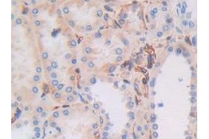 Detection of MHCC in Human Kidney Tissue using Polyclonal Antibody to Major Histocompatibility Complex Class I C (MHCC) (MHCC (AA 48-305) 抗体)