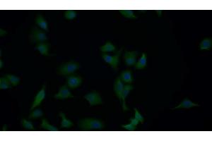 Detection of APAF1 in Human Hela cell using Polyclonal Antibody to Apoptotic Peptidase Activating Factor 1 (APAF1) (APAF1 抗体  (AA 31-350))