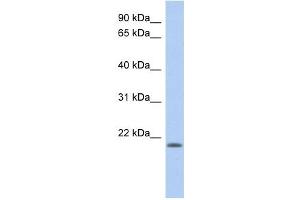 CHAC2 antibody used at 1 ug/ml to detect target protein. (CHAC2 抗体)