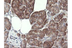 Image no. 11 for anti-Methionyl Aminopeptidase 2 (METAP2) (AA 2-212) antibody (ABIN1491153)