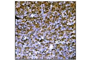 IHC analysis of PML Protein/Pml using anti-PML Protein/Pml antibody (ABIN7599678). (PML 抗体  (AA 107-857))