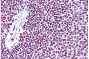 Human Spleen: Formalin-Fixed, Paraffin-Embedded (FFPE) (p300 抗体  (AA 731-831))