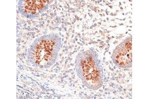 Immunohistochemistry of paraffin-embedded Human appendix using KIR3DL3 Polyclonal Antibody at dilution of 1:100 (40x lens). (KIR3DL3 抗体)