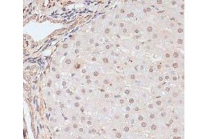 Immunohistochemistry of paraffin-embedded Rat liver using Phospho-BRCA1(S1423) Polyclonal Antibody at dilution of 1:100 (40x lens). (BRCA1 抗体  (pSer1423))