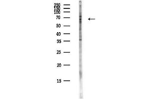 anti-Suppression of Tumorigenicity 7 (ST7) antibody