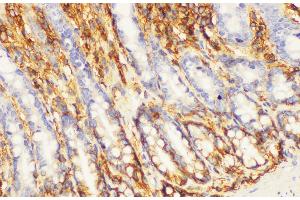 Immunohistochemistry of paraffin-embedded Rat colon using CD44 Polycloanl Antibody at dilution of 1:200 (CD44 抗体)