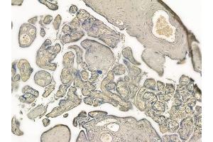 ABIN6257334 and ABIN6274315 at 1/100 staining human normal placenta tissue by IHC-P. (MVK 抗体  (Internal Region))