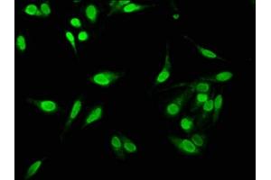 Immunofluorescence staining of Hela cells with ABIN7161811 at 1:533, counter-stained with DAPI. (C1D 抗体  (AA 1-135))