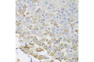 Immunohistochemistry of paraffin-embedded rat liver using TROVE2 antibody (ABIN5975457) at dilution of 1/100 (40x lens). (TROVE2 抗体)
