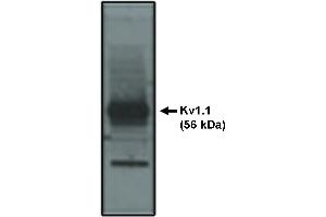 Western blot analysis using Kv1. (Kv1.1 Potassium Channel 抗体)