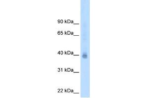 Western Blotting (WB) image for anti-Nuclear Receptor Subfamily 2, Group F, Member 2 (NR2F2) (N-Term) antibody (ABIN2781130)