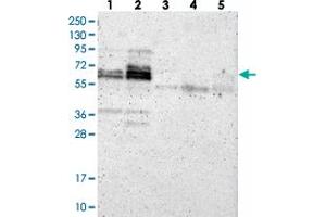 Western blot analysis of Lane 1: Negative control (vector only transfected HEK293T lysate). (ZNF135 抗体)
