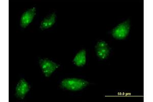 Immunofluorescence of purified MaxPab antibody to ZNF576 on HeLa cell. (ZNF576 抗体  (AA 1-170))
