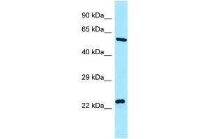 WB Suggested Anti-NCLN Antibody Titration: 1. (Nicalin 抗体  (C-Term))