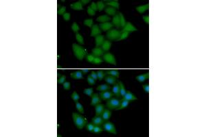 Immunofluorescence analysis of U2OS cells using CAMK1 antibody (ABIN5974223). (CAMK1 抗体)
