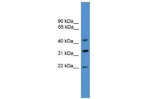 Western Blot showing ARFIP1 antibody used at a concentration of 1-2 ug/ml to detect its target protein. (ARFIP1 抗体  (C-Term))