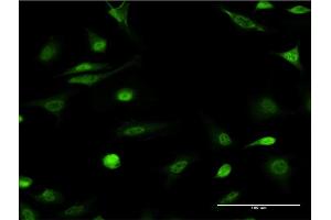 Immunofluorescence of monoclonal antibody to ID1 on HeLa cell. (ID1 抗体  (AA 47-155))