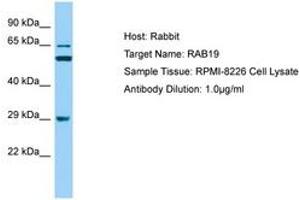 Image no. 1 for anti-RAB19, Member RAS Oncogene Family (RAB19) (AA 40-89) antibody (ABIN6749888) (RAB19 抗体  (AA 40-89))