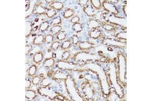Immunohistochemistry of paraffin-embedded mouse kidney using CYCS antibody.