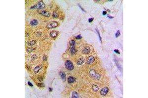 Immunohistochemical analysis of FBP1 staining in mouse pancreas formalin fixed paraffin embedded tissue section. (FBP1 抗体)