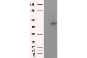 Image no. 2 for anti-Nucleotide Exchange Factor SIL1 (SIL1) antibody (ABIN1496811) (SIL1 抗体)