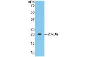 Detection of Recombinant NCCT, Human using Polyclonal Antibody to Na-Cl Cotransporter (NCCT) (SLC12A3 抗体  (AA 867-1024))