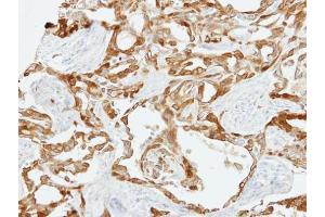 IHC-P Image Immunohistochemical analysis of paraffin-embedded H661 xenograft, using Fibulin 2, antibody at 1:500 dilution. (FBLN2 抗体  (N-Term))