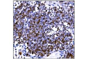 IHC analysis of PML Protein/Pml using anti-PML Protein/Pml antibody (ABIN7599678). (PML 抗体  (AA 107-857))