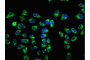 Immunofluorescence staining of Hela cells with ABIN7175196 at 1:133, counter-stained with DAPI. (VSIG8 抗体  (AA 285-414))