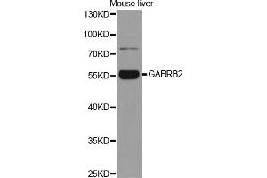 Western blot analysis of extracts of mouse liver, using GABRB2 antibody (ABIN5970962) at 1/1000 dilution. (GABRB2 抗体)